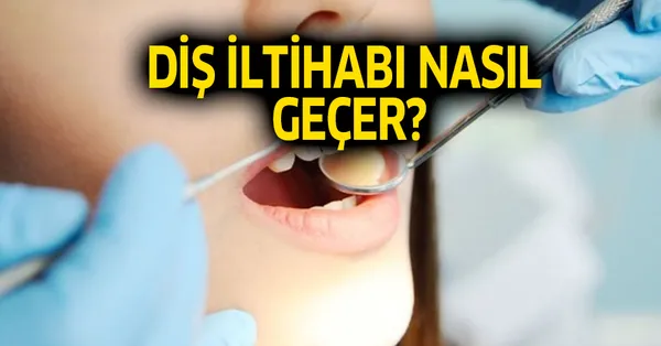 dis apsesi nedir dis iltihabi nasil