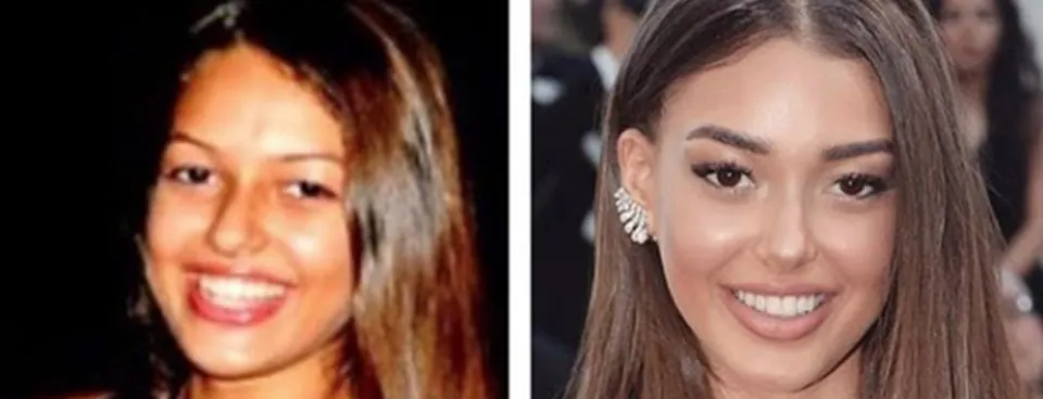 Cukur Un Yildizi Dilan Cicek Deniz In Degisimi Soke Etti Unlulerin Eski Ve Yeni Halleri Galeri Takvim Cukur Un Yildizi Dilan Cicek Deniz In Degisimi Soke Etti Unlulerin Eski Ve Yeni Halleri Galeri Takvim