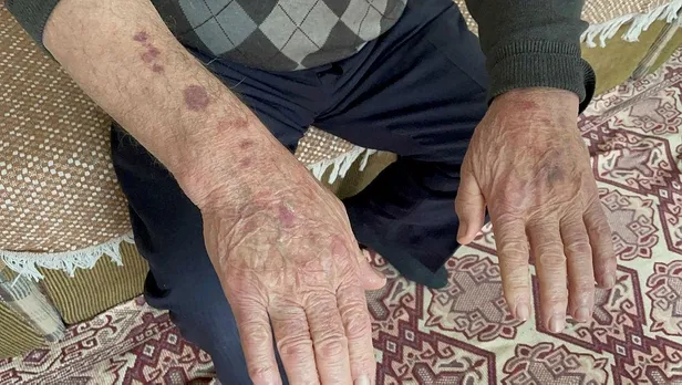 75-yasindaki-yolcuyu-darbeden-iett-soforu-tutuklandi-1649774981874.jpeg 75 yaşındaki yolcuyu darbeden İETT şoförü tutuklandı!-4