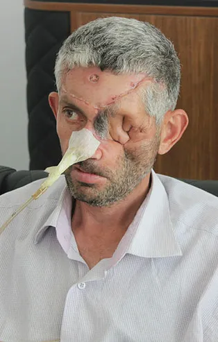 Günlerce diş ağrısı çekip doktora gitti! Sonrası korkunç...