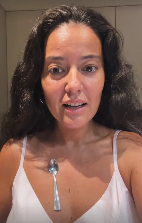 pelin-akil-vucudundaki-metal-kasiklari-gosterip-yardim-istedi-1787897395953.png Pelin Akil vücudundaki metal kaşıkları gösterip yardım istedi: “Aklımı kaybedeceğim”-3