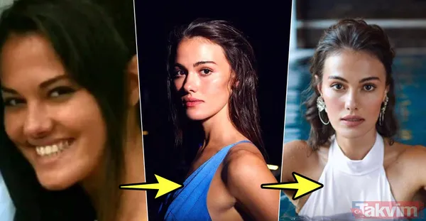 Bir Zamanlar Kıbrıs'ın Ayşe'si Gülper Özdemir'in duru güzelliğinin altında estetik yatıyormuş! Adeta yepyeni bir yüz... - 19