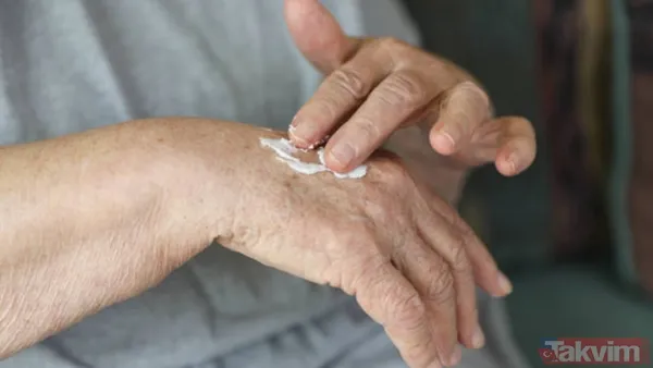 Kış aylarında cildiniz neden kuruyor? Sebebi sandığınızdan farklı - 7