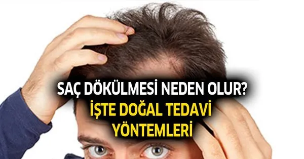 sac dokulmesine ne iyi gelir sac dokulmesi nasil gecer evde dogal tedavi yontemler takvim