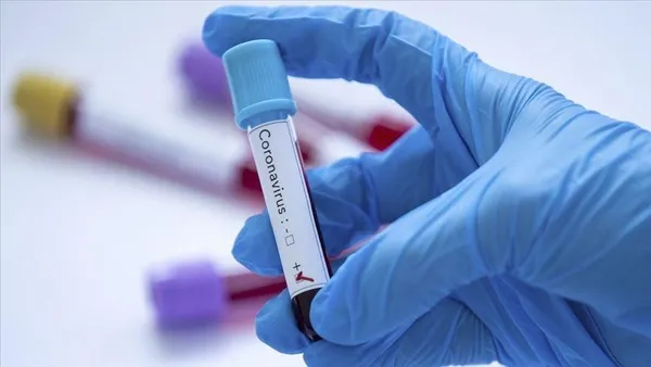 Sağlık Bakanı Fahrettin Koca, pandemiyle mücadelede son durumu değerlendirdi-13