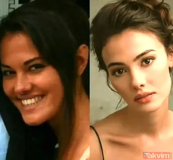 Bir Zamanlar Kıbrıs'ın Ayşe'si Gülper Özdemir'in duru güzelliğinin altında estetik yatıyormuş! Adeta yepyeni bir yüz... - 20