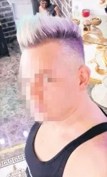 Kübra Boyraz'ı hayatından eden botoks skandalında yeni gelişme! Botoksu ilkokul mezunu yapmış-2