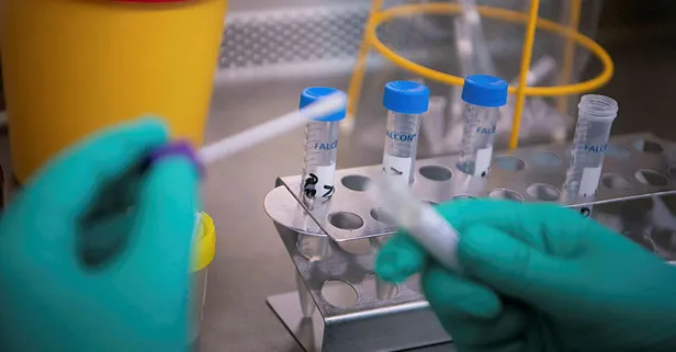 Koronavirus Testi Yapan Hastaneler Hangisi Saglik Ocagi