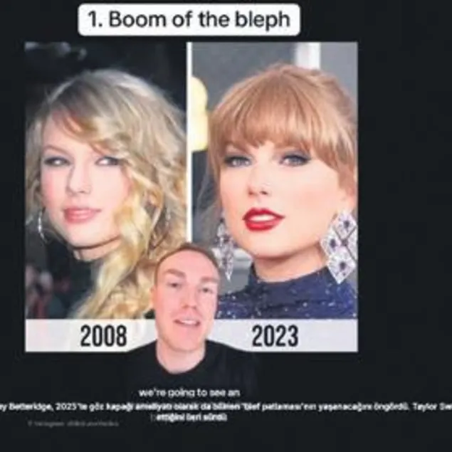 Gözünün şeklini değiştirdi