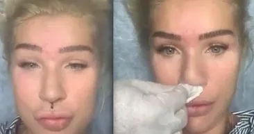 Seda Sayan yine canlı yayında estetik yaptırdı! 57 yaşındaki Seda Sayan yine olay yarattı