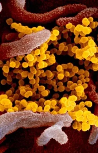 Son dakika: Koronavirüs aşısıyla ilgili Türkiye'den büyük başarı! Tüm gen haritası çıkarıldı