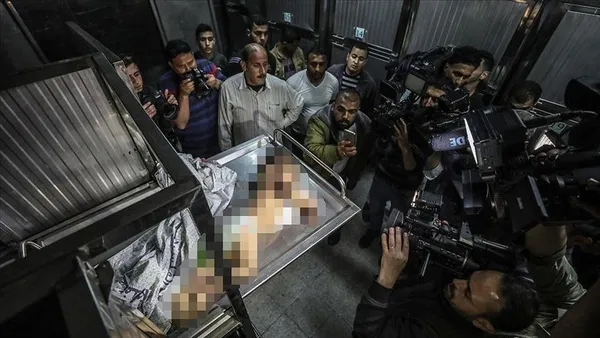 vicdanlarina-ezik-dustuler-bbc-calisanlari-tuvaletlerde-agliyor-iddiasi-1698357568129.jpeg Katliam karşısında vicdan azabı! Siyonist İsrail'in katliamlarına dayanamayan BBC çalışanları katledilen sivillere ağlıyor-4