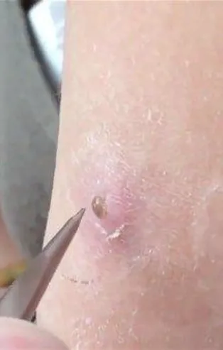 İçinden çıkanlar şok etti