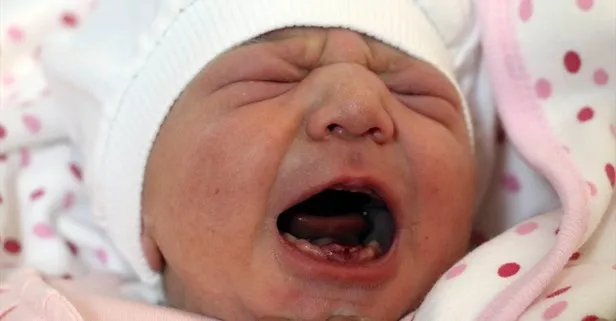 Amasya’da dokuz dişli bebek dünyaya geldi