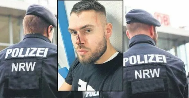 Almanya’da polis maske takmadı diye Volkan Koyugöz’ün burnunu kırdı
