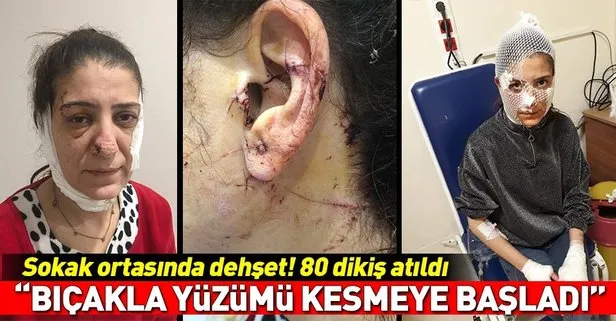Adana’da sokak ortasında dehşet! Genç kadına 80 dikiş atıldı