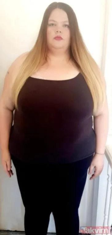 Günde 10 litre kola içen yemek bağımlısı anne Türkiye’de ameliyatla 83 kilo verdi - 2