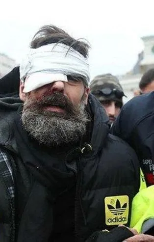 Fransa'da polis Flash-Ball mermisi kullandı 100 kişi gözünü kaybetti!