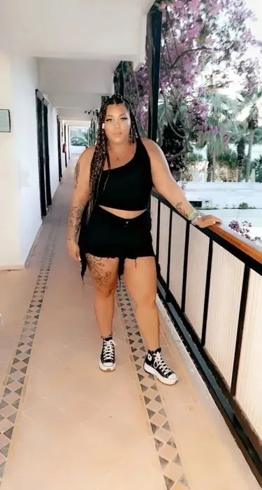 Estetik faciası! Fazla yağlarını aldırmak istedi hayatının şokunu yaşadı! 4 ayda 9 ameliyat-6