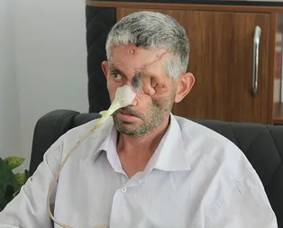 Günlerce diş ağrısı çekip doktora gitti! Sonrası korkunç...