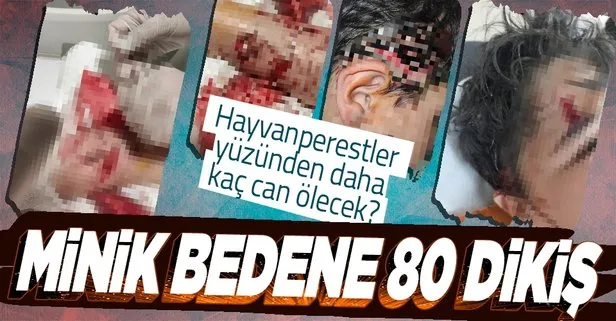 Sokak köpekleri çocuğu parçaladı! 80 dikiş