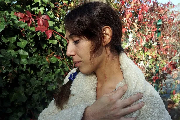 Antalya'da eski eş vahşetinden kurtulan Oya Aydoğdu: Aklıma Emine Bulut geldi-2