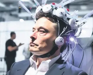 Elon ’beyin’ gördüğü!