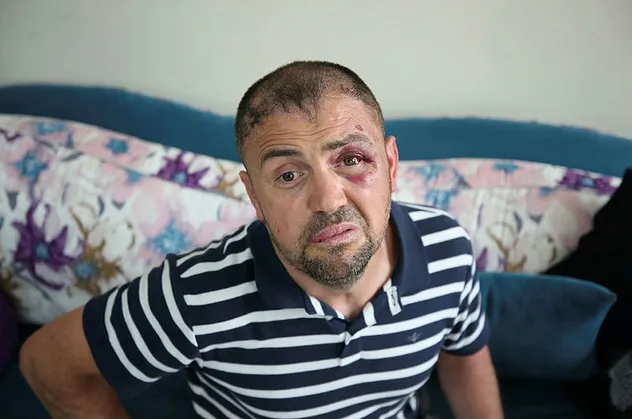 Bursa'da insanlık dışı olay! Terör gazisini öldüresiye dövdüler