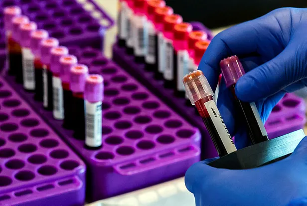 Plaquenil nedir, ne için kullanılır? Dünyaca ünlü ilaç laboratuvarından flaş koronavirüs açıklaması!-3