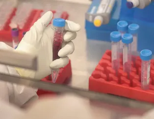 Koronavirüsle mücadelede yeni umut: Kanada'da Kovid-19'a karşı özel bir diyaliz tedavisi geliştirildi