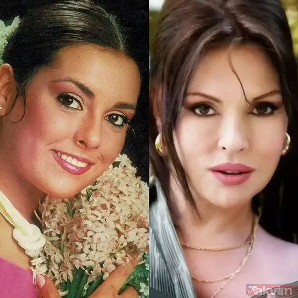 Yeşilçam'ın en güzellerindendi! 70 yaşındaki Gülşen Bubikoğlu son haliyle hayrete düşürdü! - 24