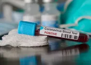 Sağlık Bakanı Fahrettin Koca duyurmuştu! Koronavirüs bağışıklık testlerine start verildi