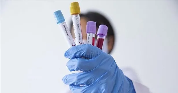 Koronavirüsü ikinci kez kapma ihtimali var mı? Koronavirüs hakkında cevabı bilinmeyen 9 soru!-8