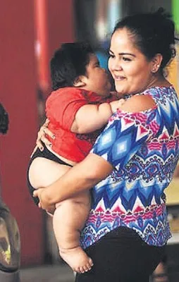 10 aylık bebek 28 kilo