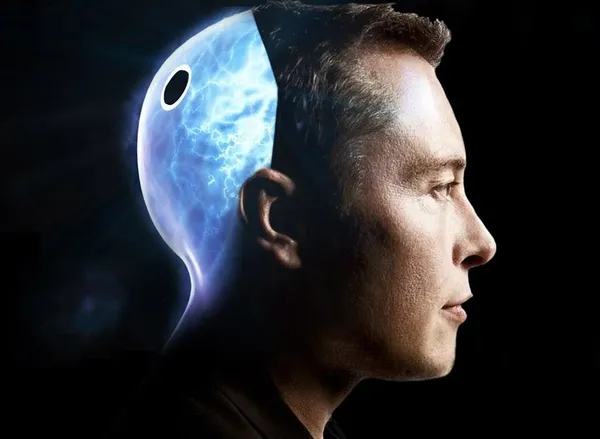 Elon Musk insanlara çip takacak: Neuralink çip tartışma konusu-12