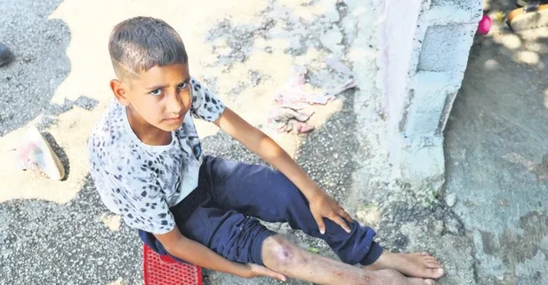 Serdal’ın sessiz çığlığı: Okula gitmek istiyorum