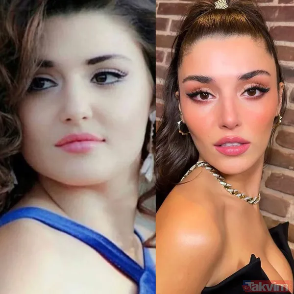 Yeşilçam’ın Sultan’ı Türkan Şoray'ın kızı Yağmur Ünal’ın son haline bakın! Botokstan konuşamadı! Gören şaştı kaldı - 12