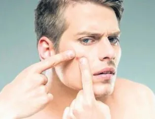 Fazla sivilce prostat habercisi