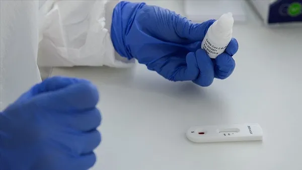 1609146449068.jpg Koronavirüste bağışıklık sisteminizi bu 8 hata etkileyebilir-4