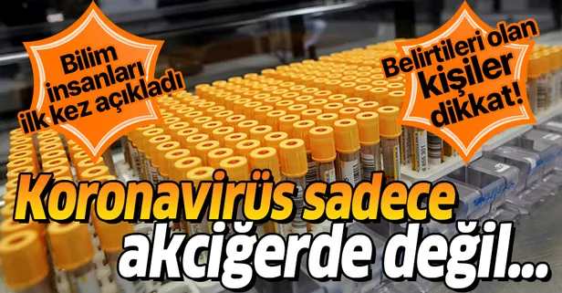 Bilim insanları ilk kez açıkladı! Koronavirüs sadece akciğerde değil...
