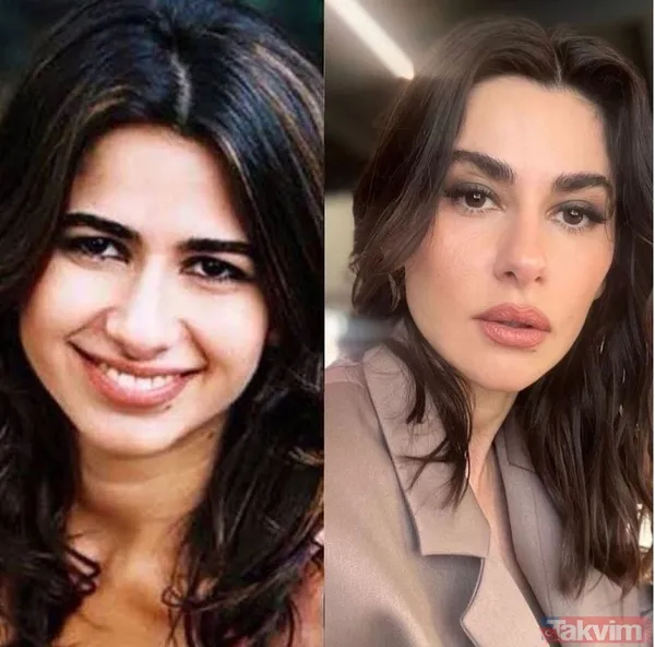 Esra Bilgiç estetik harikası çıktı! Eski halini görenin gözleri fal taşı gibi açıldı: Doğal sanıyordum! Diriliş Ertuğrul’un yıldızı... - 9