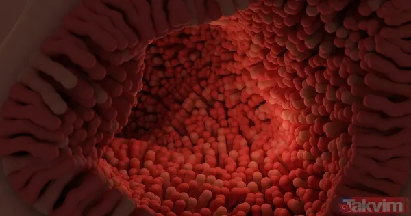 Saraçoğlu önerdi! Bağırsak iltihabını duran 2 bitkisel çözüm - 9