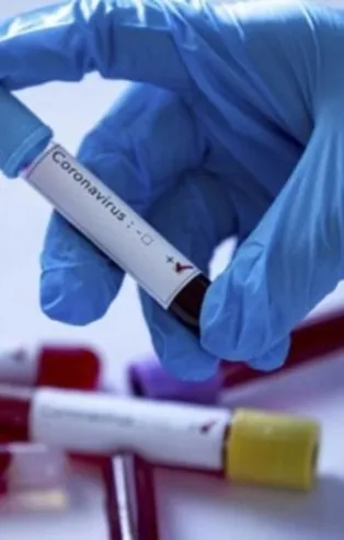 Koronavirüsün etkisi arttı mı azaldı mı? Bilim Kurulu Üyesi'nden dikkat çeken açıklama