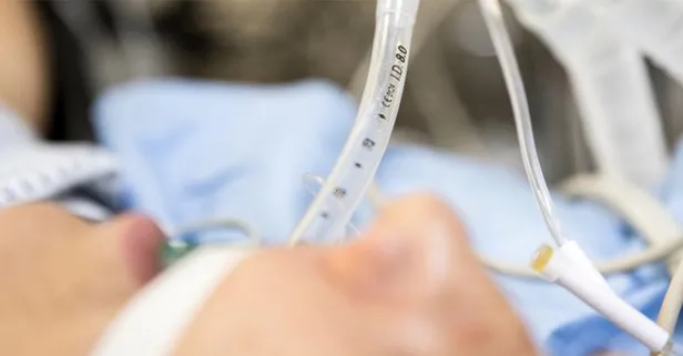 Oksijene bağlıyken sigara içmek isteyen adam öldü