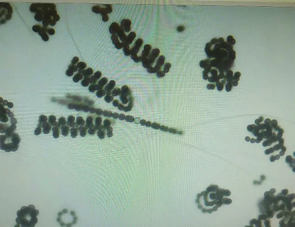 İstanbul’da siyanobakteri tehlikesi! Uzman isimden kritik uyarı