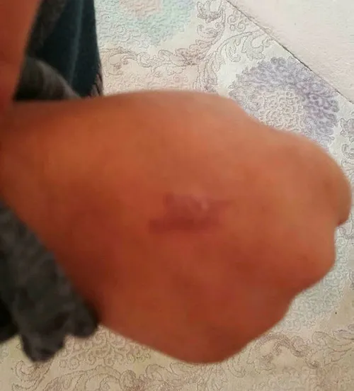 1579512532289.jpg Köy okulunda skandal! Sıcak soba ızgarasını öğrencilerin vücuduna bastı-1
