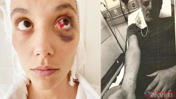 Avukat, "Ortada Böylesine Bir Darp Ve Suçun İşlendiğine Dair Ciddi Bir Şüphe Varken, Bu İtirazın Savcılık Ve Aile Mahkemesi Tarafından Ciddiye Alınmayacağına...