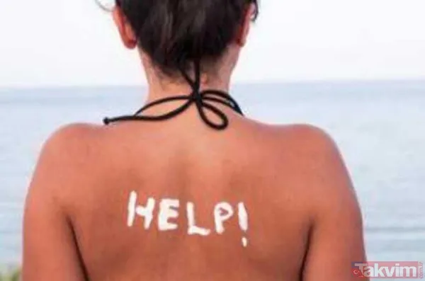 Güneş sonrası cilt yanıklarına doğal çözüm: Bu 2 malzeme evinizde var - 1