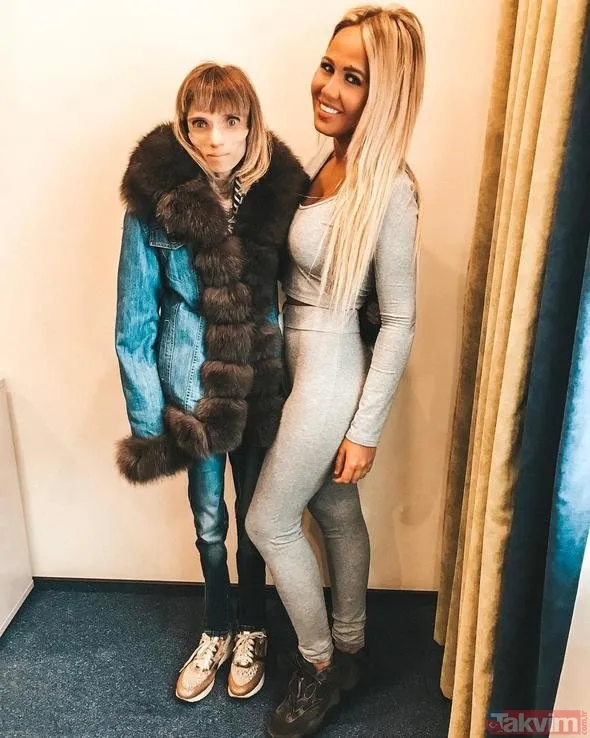 Russian announcer Kristina Karyagina at the same weight as the 4-year-old boy! (What is anorexia?)