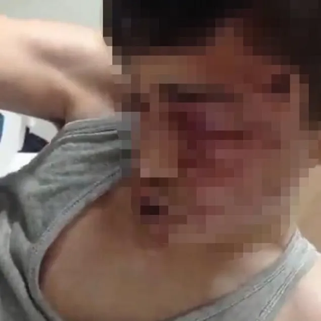 15 yaşındaki çocuğa öldüresiye dayak